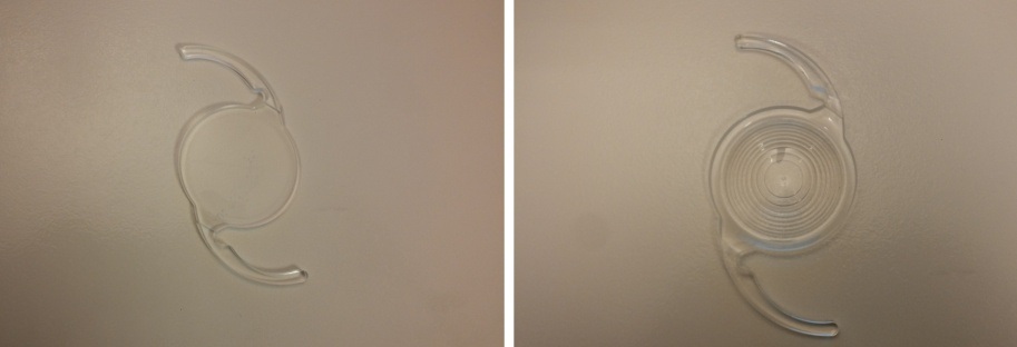 παράδειγμα monofocal και multifocal ενδοφακού